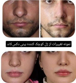 تصویر ژل کوچک کننده بینی دکس لاند نمونه اصلی 