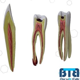 تصویر دندان سری 3 عددی 