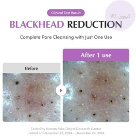 تصویر ماسک برنج بنفش اکوال بری 