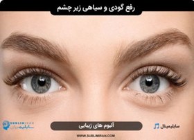 تصویر رفع گودی زیر چشم و سیاهی زیر چشم 