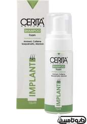 تصویر شامپو مناسب موهای کاشته شده سریتا Cerita, Hair Implant Shampoo