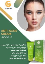 تصویر کرم ضدجوش انتی اکنه ا Anti.acne.carem Anti.acne.carem