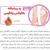 تصویر پد پیشرفته هالوکس والگوس 