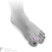 تصویر پد بین انگشتی پین مد کد ۱۰۰۳ پد بین انگشتی طبی برای کاهش درد و اصلاح فشار شست پا در هالوکس والگوس