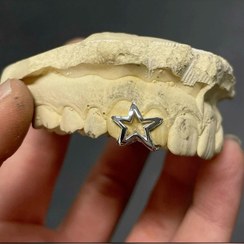 تصویر گریلز دندان پینترستی مدل ستاره 