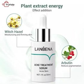 تصویر سرم ضد جوش حجم 15 میل لنبنا Lanbena Acne Treatment Serum 15 ml