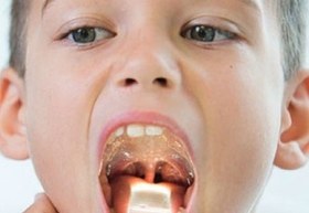 تصویر آبسلانگ چراغ دار (آبسلایت) 