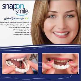 تصویر لمینت متحرک دندان ترو اسمایل true smile مجموعه 10 عددی 