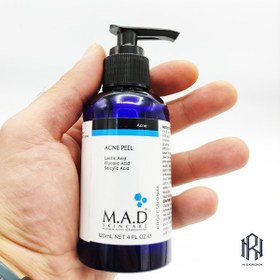 تصویر پیلینگ شیمیایی اسید تراپی ضد آکنه ام ای دی M.A.D M.A.D ACNE PEEL 120ML