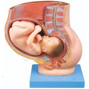 تصویر مولاژ حاملگی جنین 9 ماهه در شکم model of a 9-month-old fetus in the abdomen