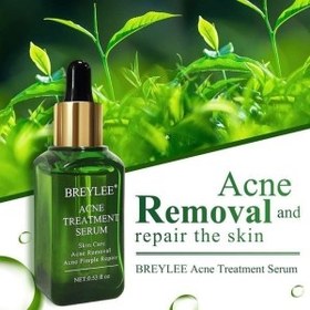 تصویر سرم چای سبز بریلی Acne treatment serum