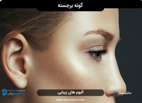 تصویر سابلیمینال گونه برجسته 