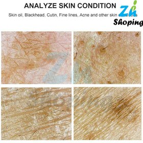 تصویر آنالیزور پوست و مو برند Best Klin مدل BD-701 