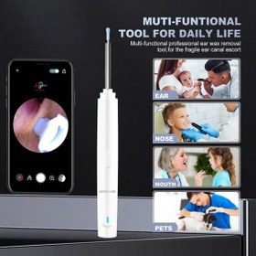 تصویر گوش پاک کن هوشمند گرین Visual Earwax Removal Tool Visual Earwax Removal Tool