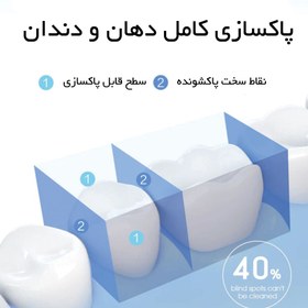 تصویر واترجت دهانشوی شیائومی مدل SOOCAS Portable Oral Irrigator W3 Pro Soocas Portable Dental Water Flosser W3 Pro