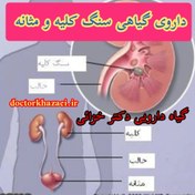 تصویر داروی گیاهی سنگ کلیه و مثانه و مجاری ادراری 