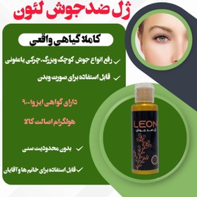 تصویر ژل ضد جوش لئون 