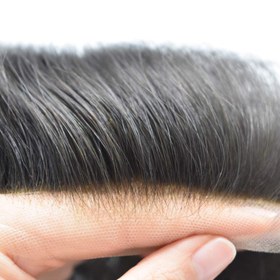 تصویر پروتز کف سر مو طبیعی مردانه (کد:8002) - 2 Men's hair prosthesis (code:8002)