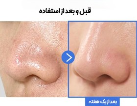 تصویر بالم پاک کننده آرایش آنزیم تیرتیر 