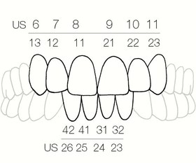 تصویر فرم دهنده کامپوزیت CoForm 