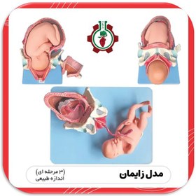 تصویر مدل سه مرحله ای زایمان Three stage model of childbirth