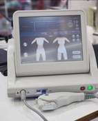 تصویر هایفو اولترا 2بعدی hifu ultra