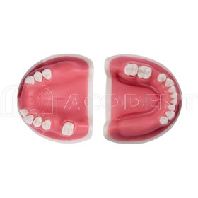 تصویر مدل فک ایمپلنت و سینوس لیفت 