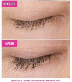 تصویر سرم تقویت مژه گرند لش Grande LASH-MD lash enhancing serum 