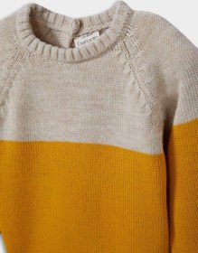 تصویر بافت بچگانه دیفکتو defacto 