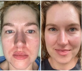 تصویر کرم رتینول ویبرانت گلمور Retinol وزن ۳۰ گرم 