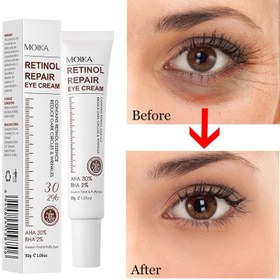 تصویر کرم دور چشم رفع چین و چروک و سیاهی رتینول مویکا MOIKA RETINOL REPAIR EYE CREAM 