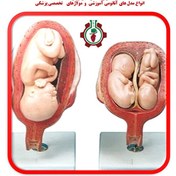 تصویر مولاژ مراحل حاملگی و رشد جنین Molage stages of pregnancy and fetal development