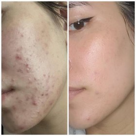تصویر سرم ضد لک و روشن کننده دارک اسپات حجم ۵۰ میلی لیتر 