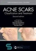 تصویر دانلود کتاب Acne Scars: Classification and Treatment 2nd Edition 