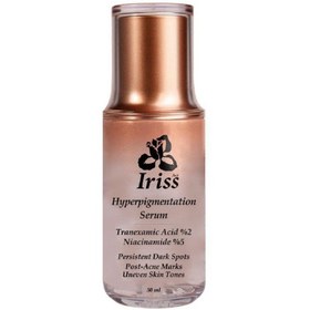 تصویر سرم هایپرپیمیگشن ایریس 