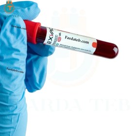 تصویر کیت پی آر اف prf ایکس وک exvac 