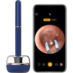 تصویر تميزکننده گوش دوربين دار شيائومی مدل Bebird Note3 Pro Earwax Remover 