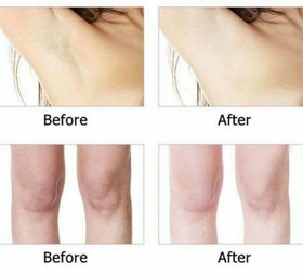 تصویر نمک بدن AHA