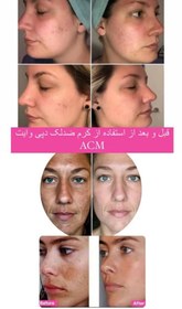 تصویر کرم ضد لک دپی وایت ای سی ام ACM ACM Depiwhite Advanced Intensive Anti-Pigmentation Spot Cream 40 ml