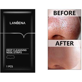 تصویر چسب زغالی جوش های سرسیاه ورقه ای لانبنا 