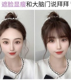 تصویر پروتز چتری 