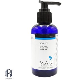 تصویر پیلینگ شیمیایی اسیدتراپی 