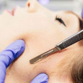 تصویر ست درما پیلینگ شامل ۱۰ تیغ و دسته شماره ۳ 