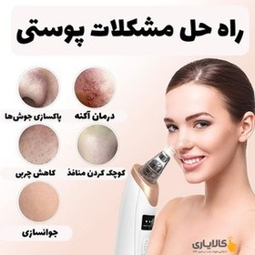 تصویر دستگاه میکرودرم خانگی HY9 | دستگاه فیشال حرفه‌ای صورت | از بین بردن جوش‌های سرسیاه و سفید 