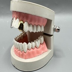 تصویر گریلز دندان 