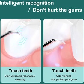 تصویر جرم گیر دندان هوشمند شیائومی Xiaomi Sunuo T12 Pro Ultrasonic Dental Scaler