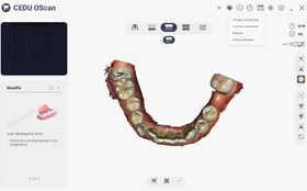 تصویر اورال اسکنر Cedu Intra Oral Scanner - Cedu