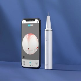 تصویر سفید‌ کننده دندان اولترا سونیک Sunuo مدل T11 Pro Sunuo T11 Pro Smart Visual Ultrasonic Dental Scaler