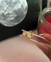 تصویر گریلز روکش دندان طلایی دوتایی 