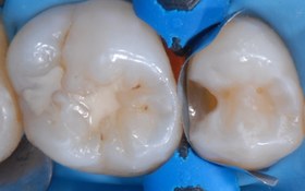 تصویر ماتریکس 3DXR سری M 